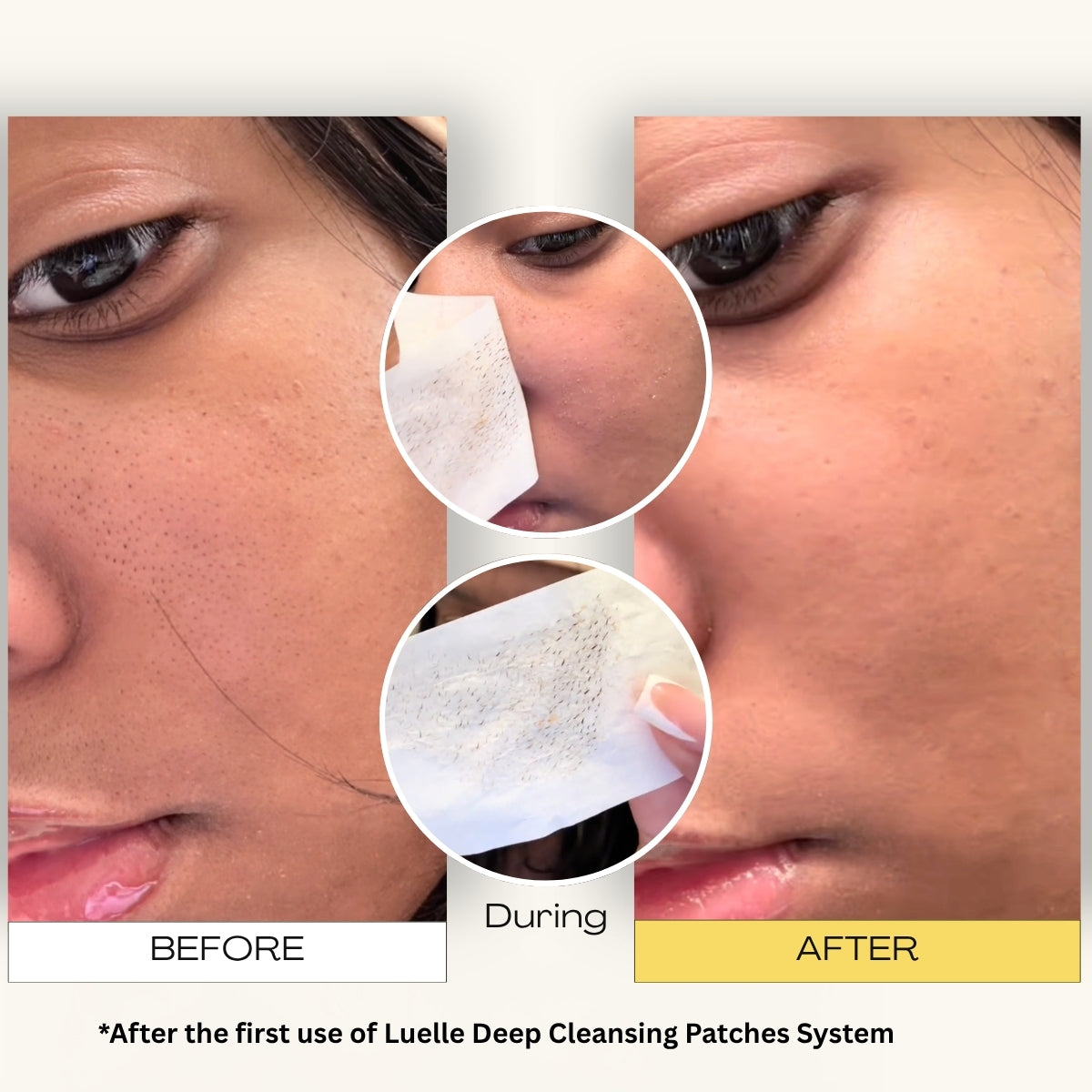 Deep Pore Cleansing System