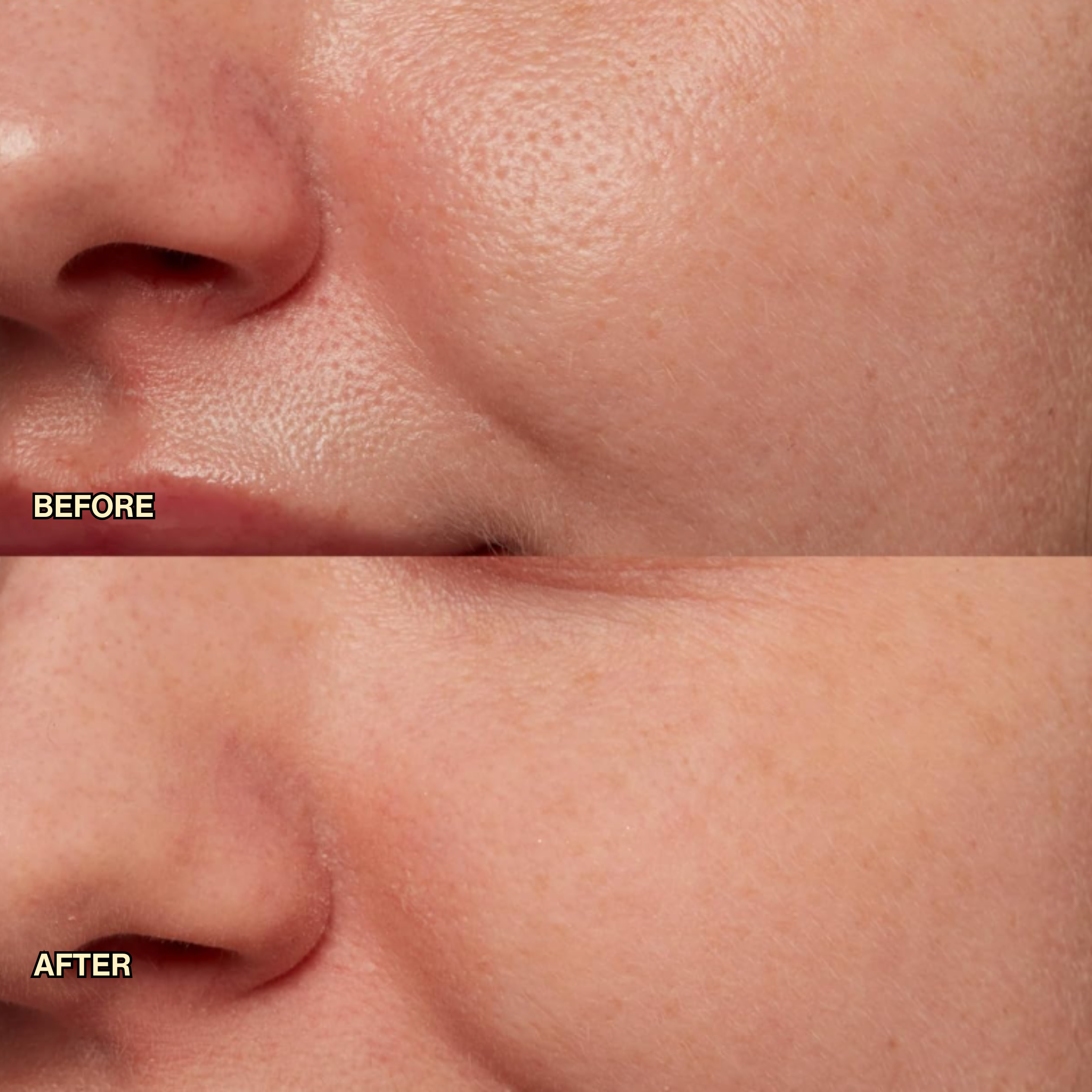 Pore Minimizing Serum