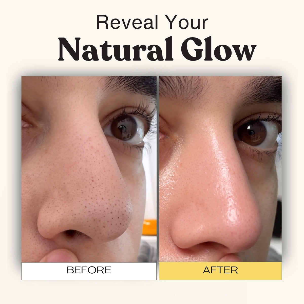 Deep Pore Cleansing & Aftercare System