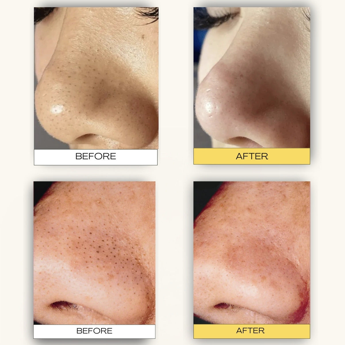Deep Pore Cleansing & Aftercare System