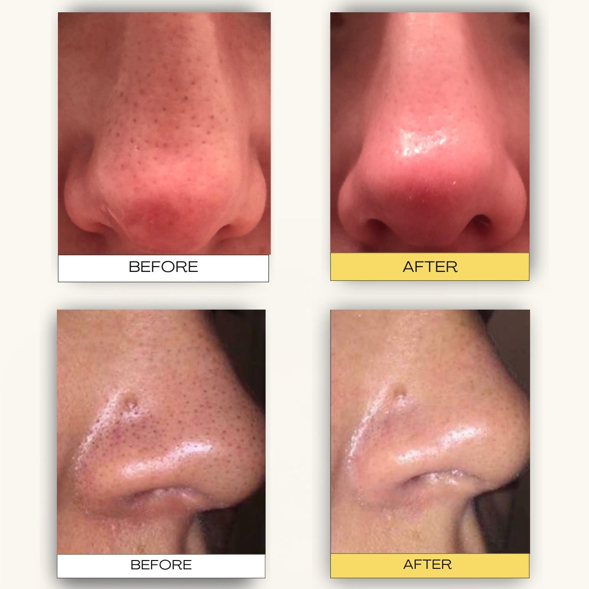 Deep Pore Cleansing & Aftercare System