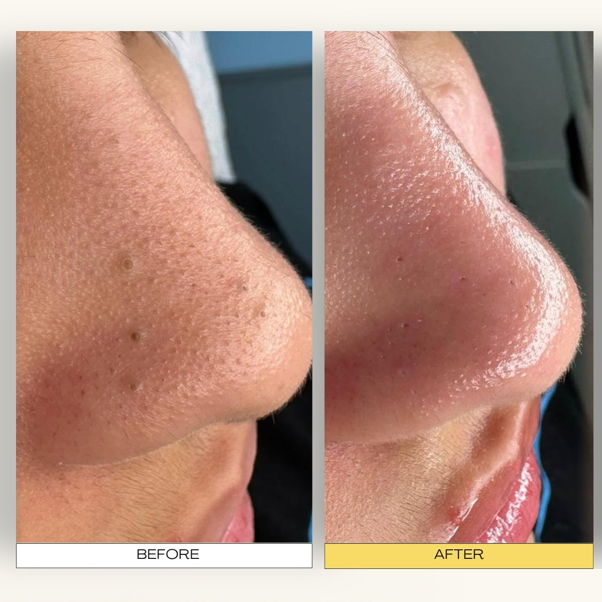 Deep Pore Cleansing System