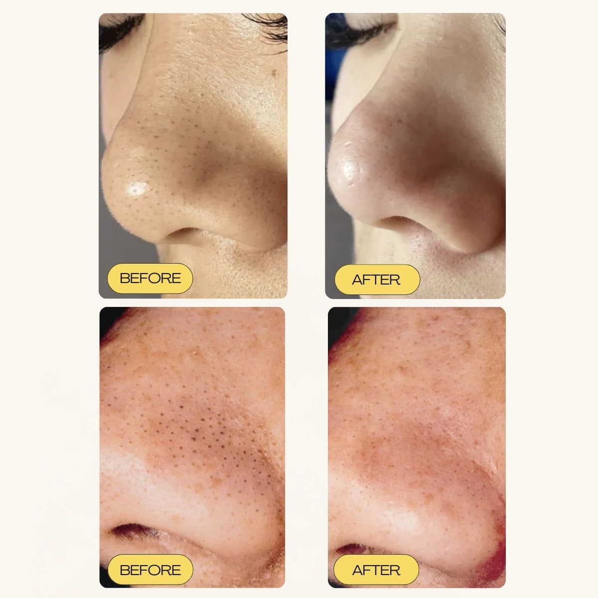 Deep Pore Cleansing & Aftercare - The Flawless Base Duo