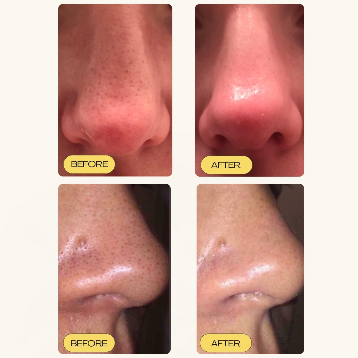 Deep Pore Cleansing & Aftercare - The Flawless Base Duo