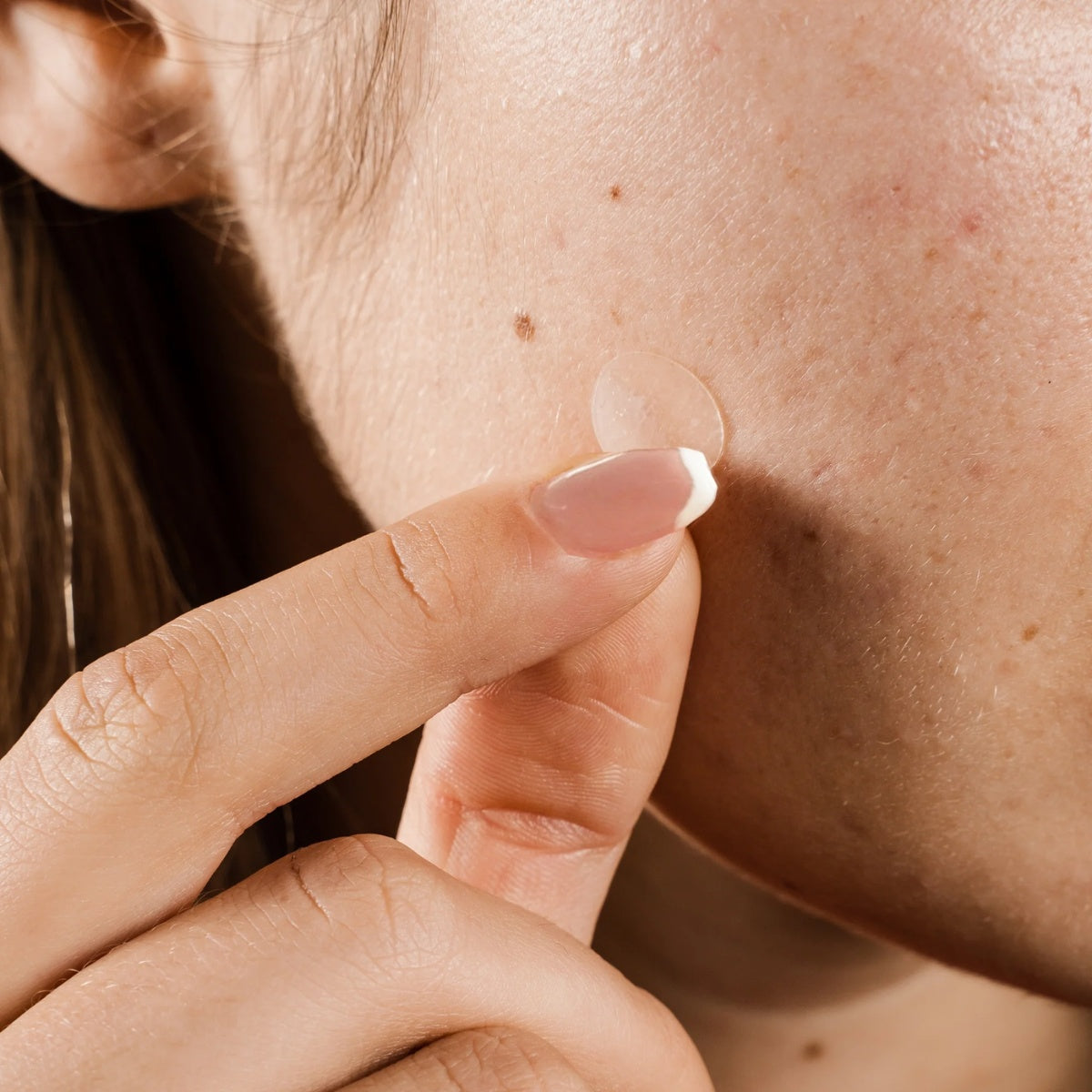 Pimple Patches