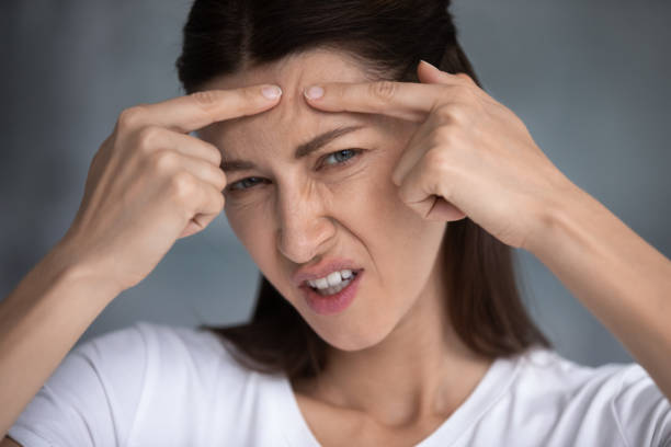 Are blackheads harmful to the skin, or are they simply an unsightly issue?