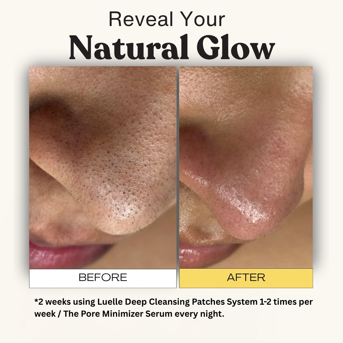 Pore Cleansing & Aftercare System