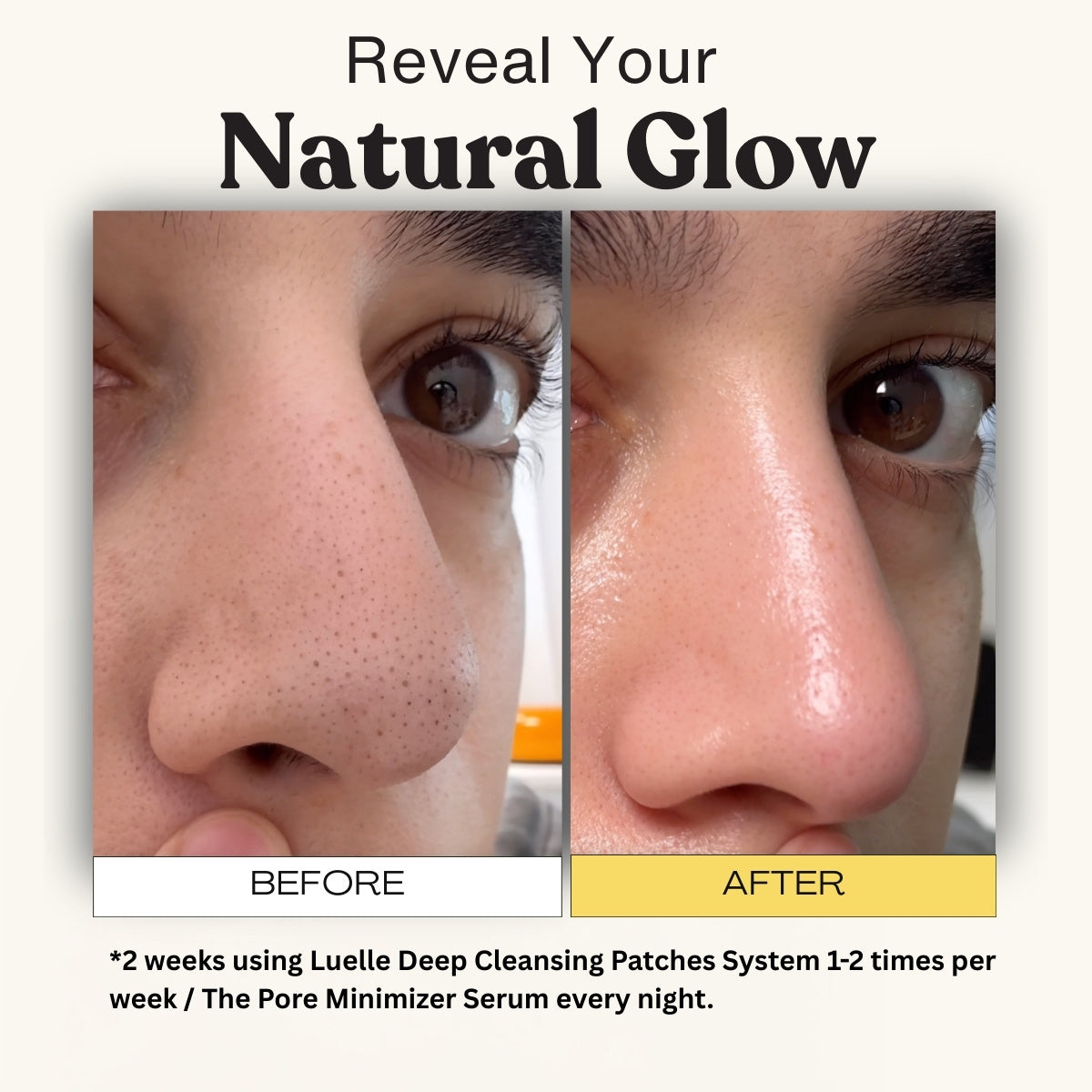 Deep Cleansing Patch System