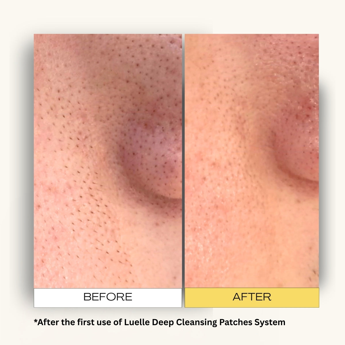 Pore Cleansing & Aftercare System