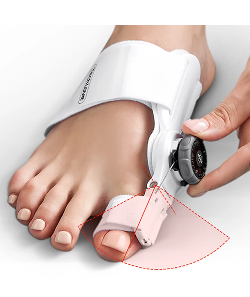 Hallufix™ - Bunion Corrector - Melius